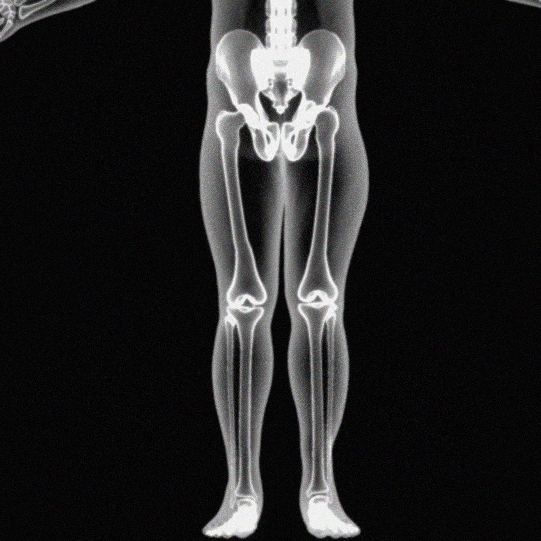 X Ray Skeleton Xray Body Human Obj