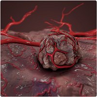 Tumor and Vessel
