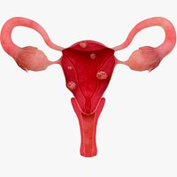 Anatomy features of diseased uterus uterine fibroids female
