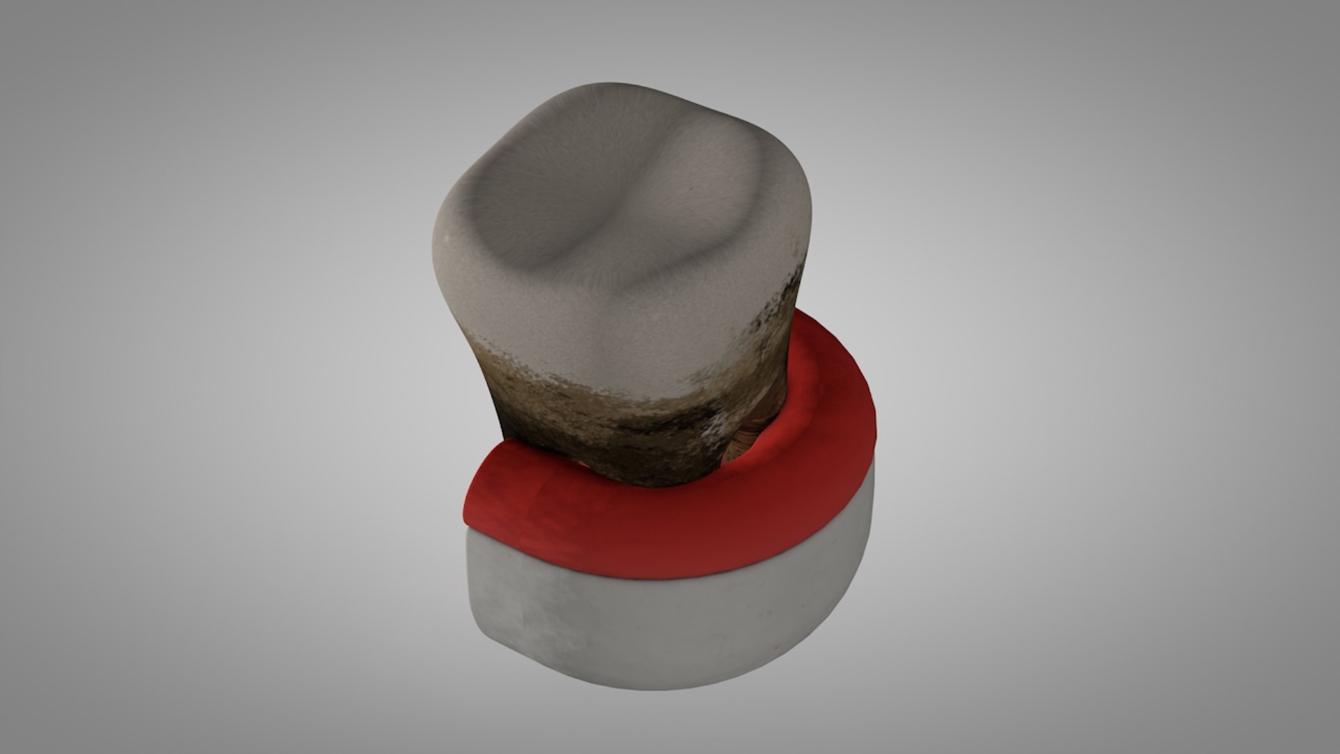 plaque tartar infection model https://p.turbosquid.com/ts-thumb/0P/Rdueje/Dy4t45wy/cenital2/jpg/1599811593/1920x1080/fit_q87/db50a30f77c55385b2d4fe52ae2c30ef309f1501/cenital2.jpg