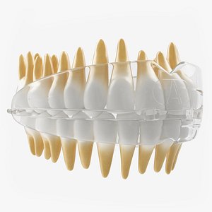 dental orthodontic tooth retainer 3D model