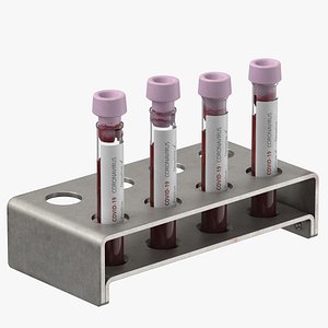 Coronavirus Blood Samples 02 Mixed 03