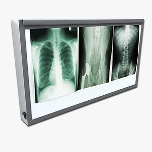X-ray Lightbox