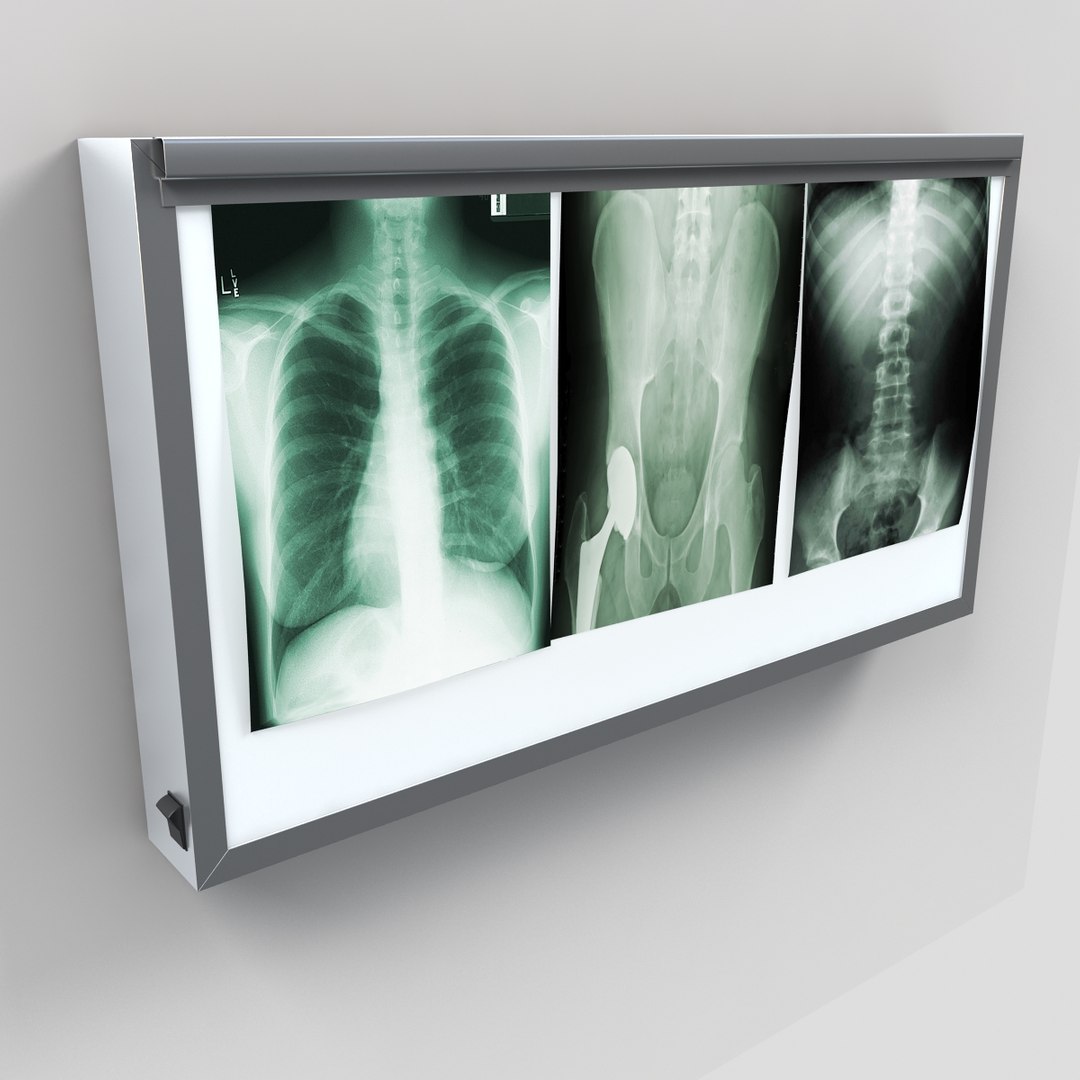 Xray Lightbox Lighting 3d Model
