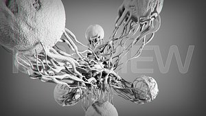 Cancer Stl Model