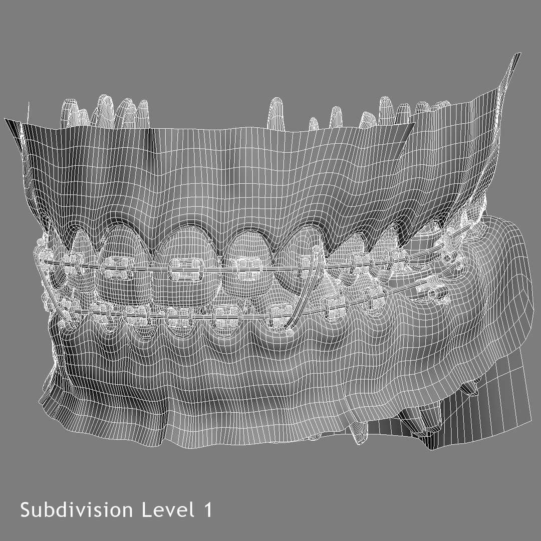 realistic dentition braces 3d max https://p.turbosquid.com/ts-thumb/0i/qVXpaE/UA2zTucS/orthosubdivisionlevels1/jpg/1409096337/1920x1080/fit_q87/ed078c1e5c96047aadb8aebb54daebf10145db8d/orthosubdivisionlevels1.jpg
