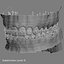 realistic dentition braces 3d max