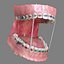 Dentizione permanente con bretelle
