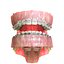 Dentizione permanente con bretelle