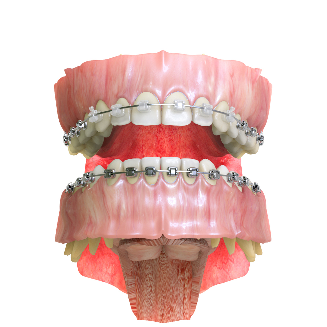 realistic dentition braces 3d max https://p.turbosquid.com/ts-thumb/0i/qVXpaE/vR6Ta4ck/cyr/jpg/1409095812/1920x1080/turn_fit_q99/b1e80b8a5fa8bd046190b039e306ee224de5003a/cyr-1.jpg