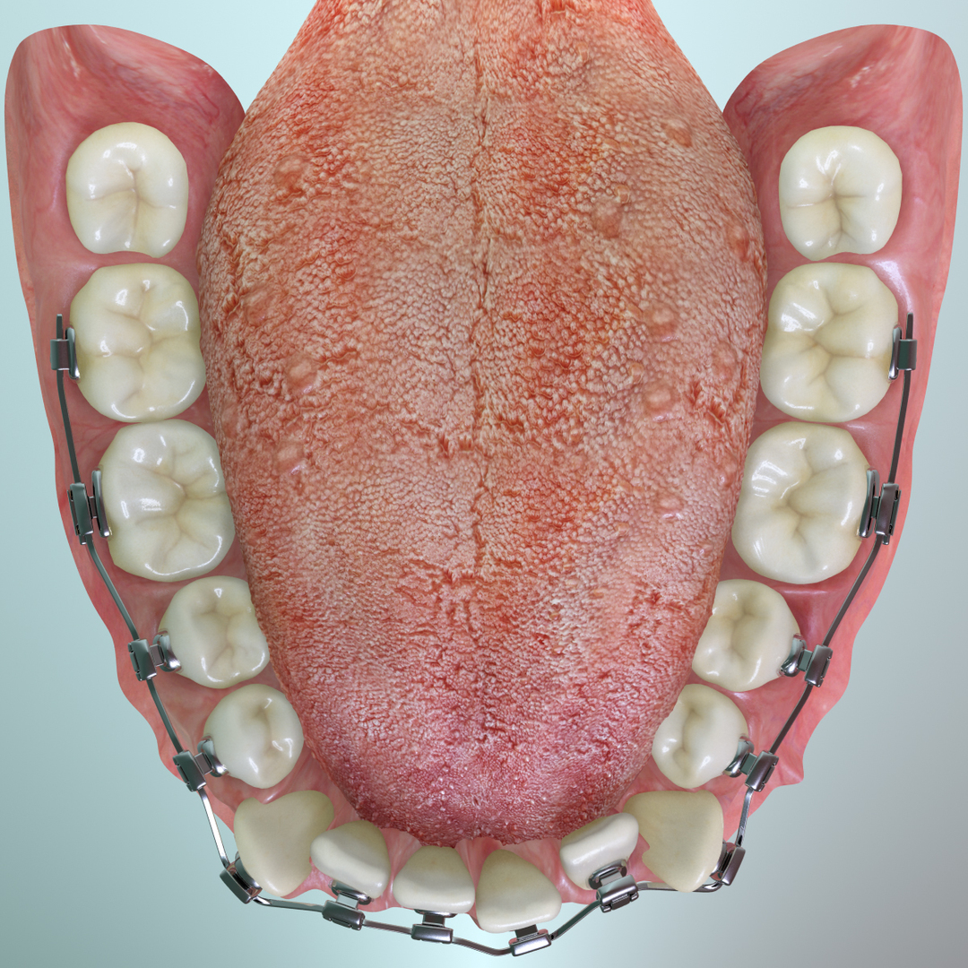 realistic dentition braces 3d max https://p.turbosquid.com/ts-thumb/0i/qVXpaE/yLR0VpzA/lower/jpg/1409095268/1920x1080/turn_fit_q99/8d0b1cd91770d84235bf78644681ad9d96fa806f/lower-1.jpg