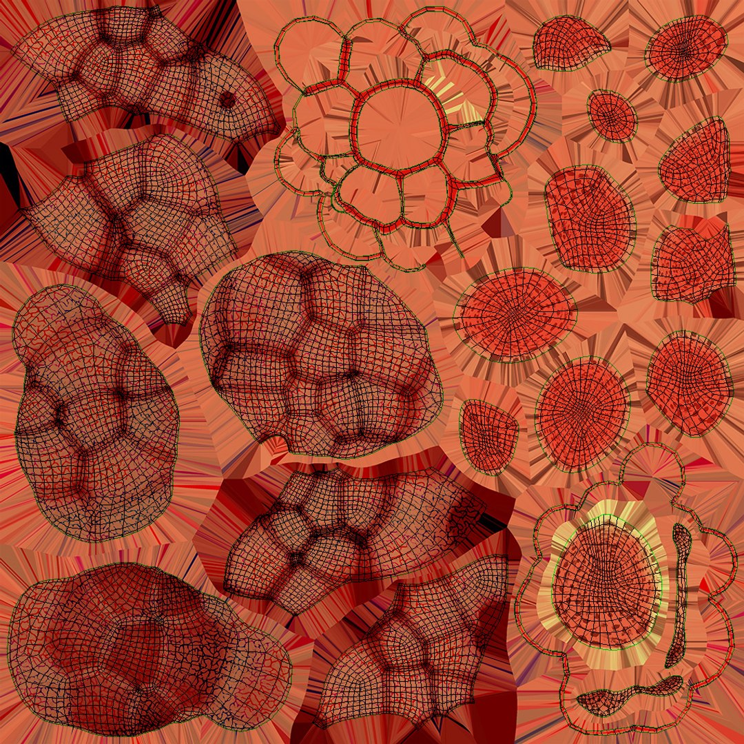 3D bronchitis alveoli mucus lungs - TurboSquid 1663222