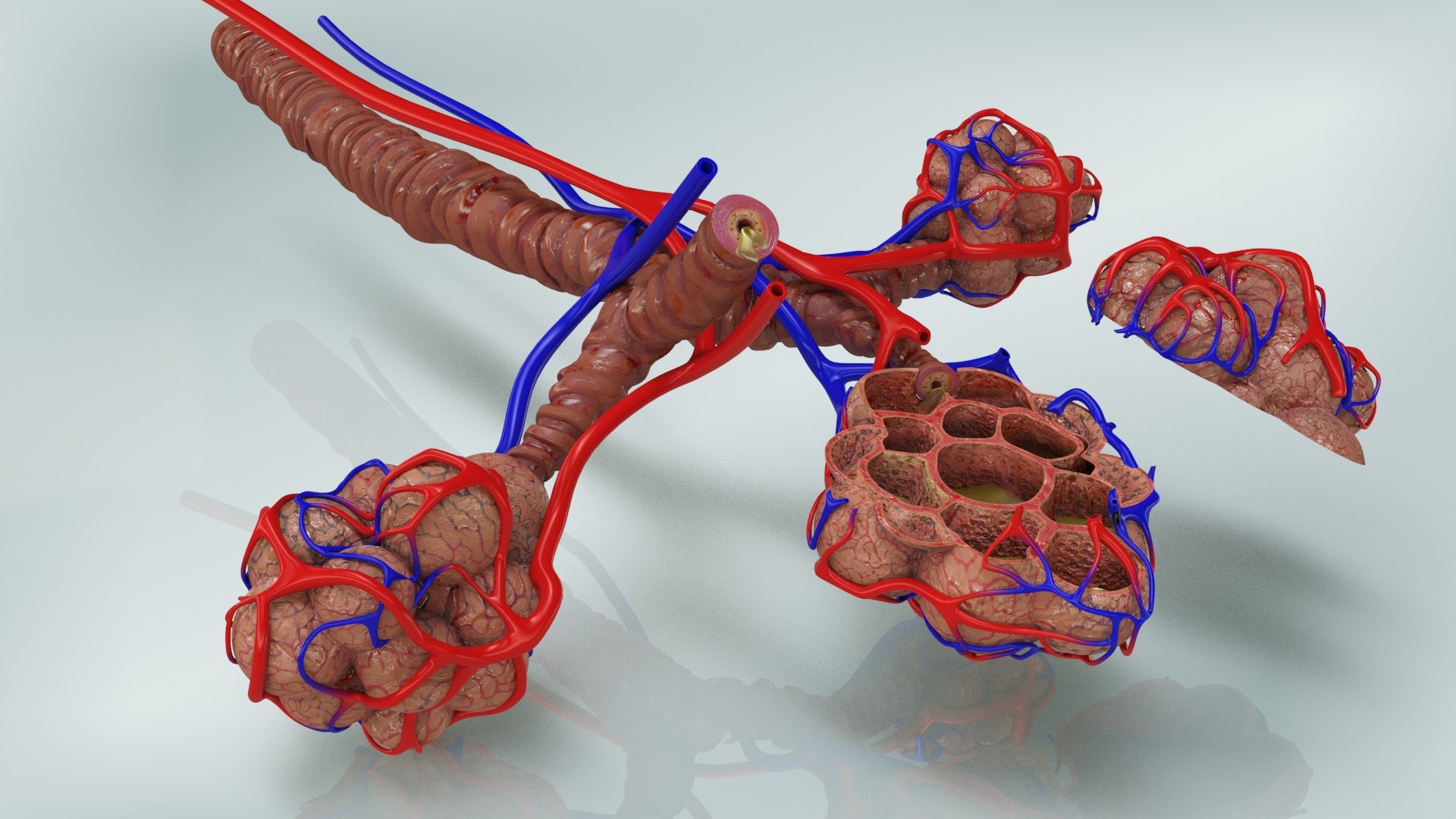 3D Bronchitis Alveoli Mucus Lungs - TurboSquid 1663222