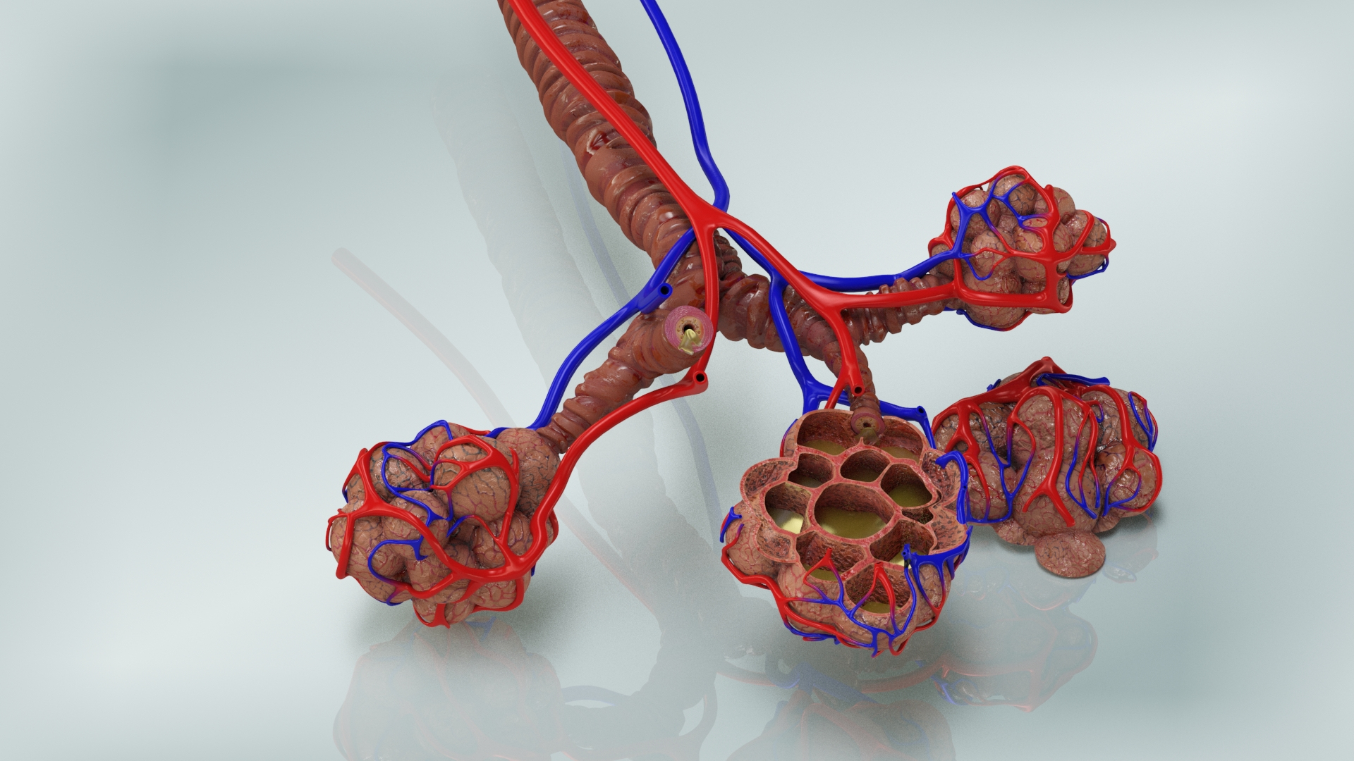 3D bronchitis alveoli mucus lungs - TurboSquid 1663222