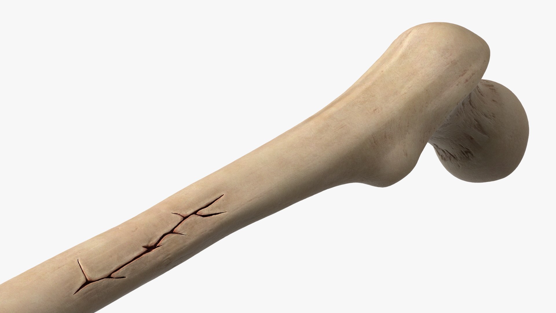 3D Human Femur Bone Anatomy https://p.turbosquid.com/ts-thumb/0r/d9NYAy/Ad/human_femur_bone_anatomy_008/jpg/1782796077/1920x1080/fit_q87/9dd7eb21caeefdc93035469dbf8f4bad1af32c38/human_femur_bone_anatomy_008.jpg