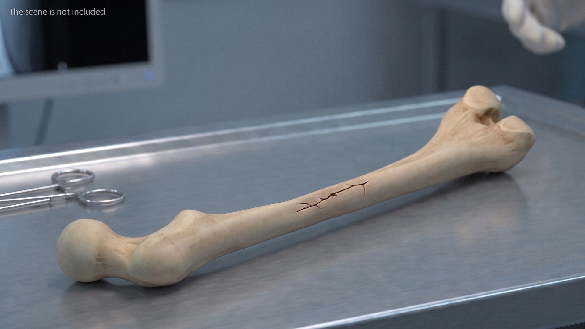3D Human Femur Bone Anatomy https://p.turbosquid.com/ts-thumb/0r/d9NYAy/GH/human_femur_bone_anatomy_003/jpg/1782796064/1920x1080/fit_q87/ffcde909f914149d0115aed543c2212e1f47ce30/human_femur_bone_anatomy_003.jpg
