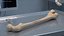 Human Femur Bone Anatomy