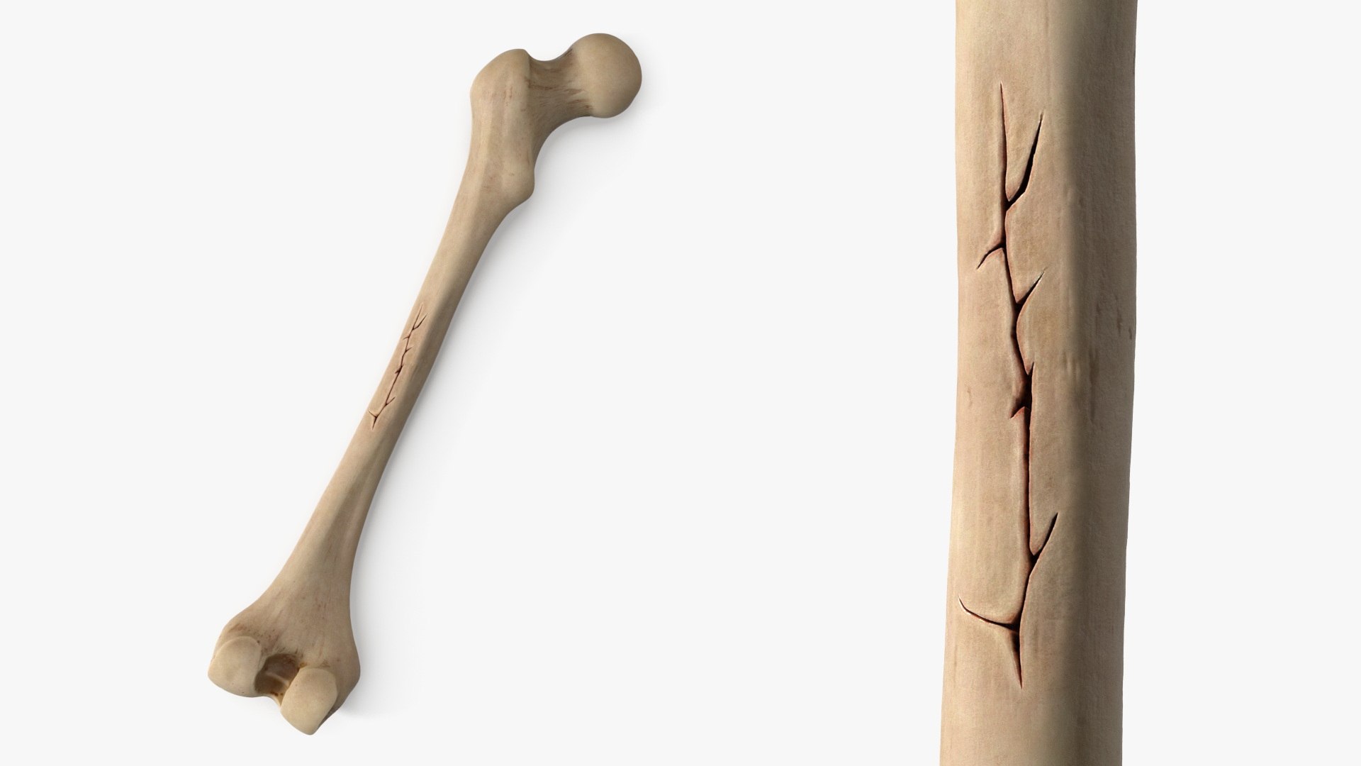 3D Human Femur Bone Anatomy https://p.turbosquid.com/ts-thumb/0r/d9NYAy/HO/human_femur_bone_anatomy_018/jpg/1786383881/1920x1080/fit_q87/4ecefbf29f39b830ebbb25ab11aed22aa4c75b85/human_femur_bone_anatomy_018.jpg