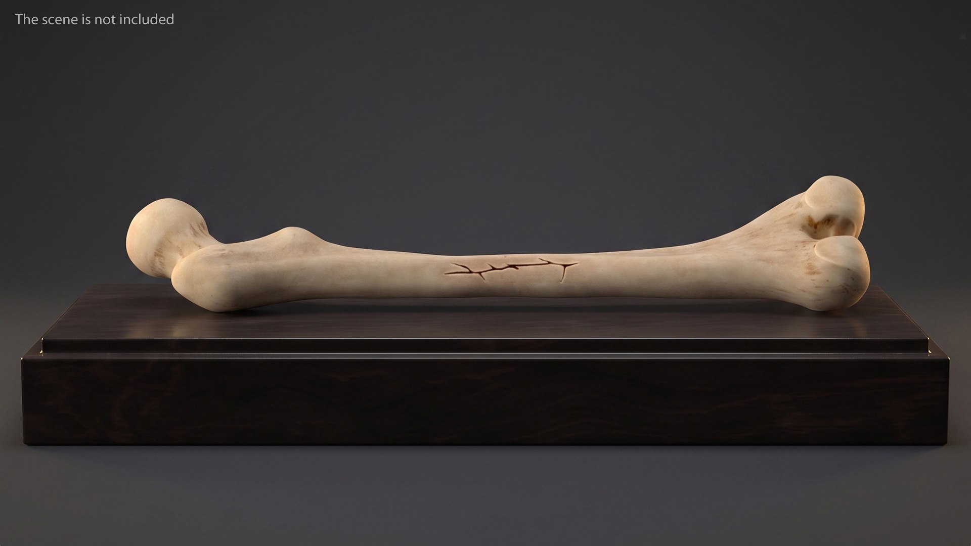 3D Human Femur Bone Anatomy https://p.turbosquid.com/ts-thumb/0r/d9NYAy/gh/human_femur_bone_anatomy_005/jpg/1782796070/1920x1080/fit_q87/efbb2c5d8d6d995dae7b0e7cd13a9f2595ae5612/human_femur_bone_anatomy_005.jpg