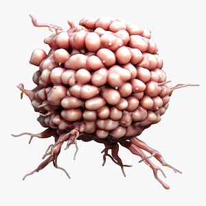 3D Cancer Cell Tumor