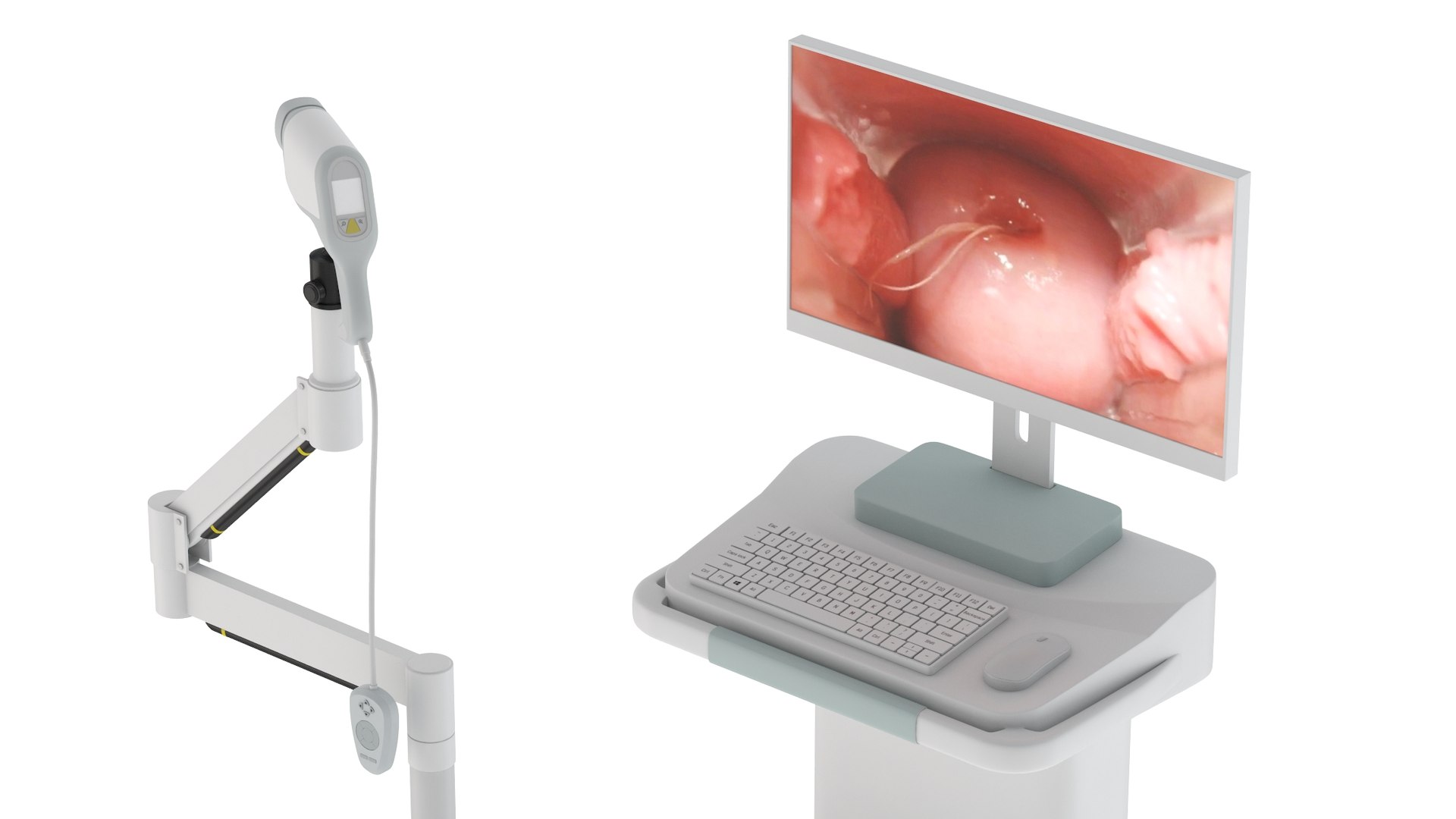 Medical Colposcopes PBR Realistic Model - TurboSquid 2020641