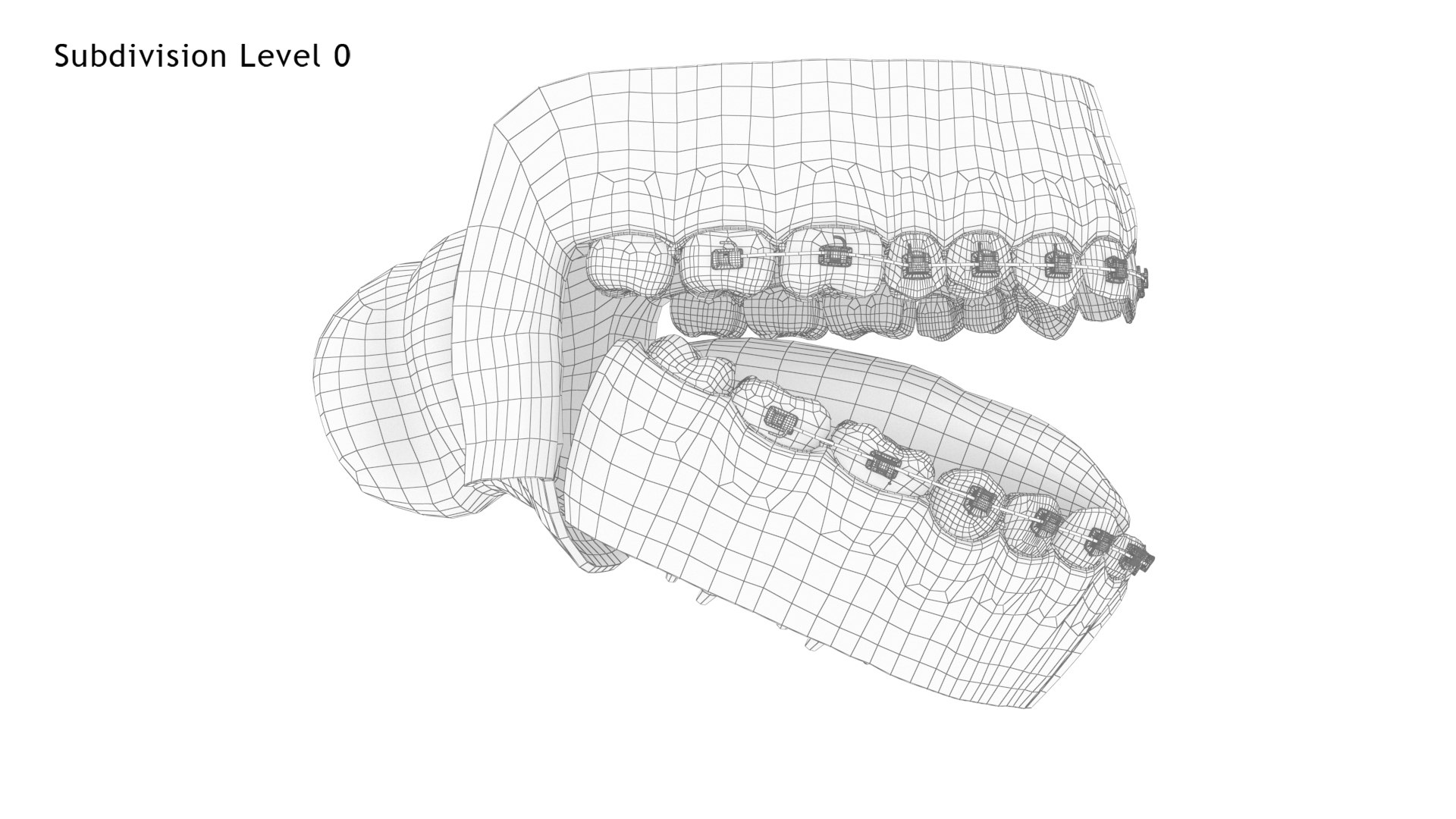 Human Mouth With Self Ligating Transparent Dental Braces V02 model https://p.turbosquid.com/ts-thumb/1e/DwIjGZ/AD/mouthwithselfligatingsteeldentalbraces_wire2.0/jpg/1709546313/1920x1080/fit_q87/b806fa279b2d5cca6bec783175bb865f2556665b/mouthwithselfligatingsteeldentalbraces_wire2.0.jpg
