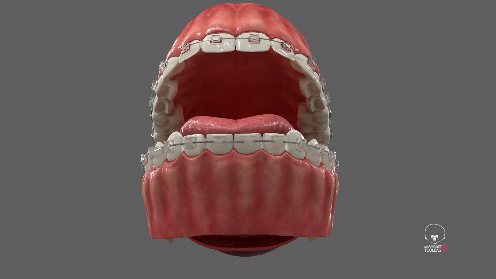 Human Mouth With Self Ligating Transparent Dental Braces V02 model https://p.turbosquid.com/ts-thumb/1e/DwIjGZ/Ih/screenshot005/jpg/1709546274/1920x1080/fit_q87/bad999907047d7bde9a983c6f735cb0f3d80a1a9/screenshot005.jpg