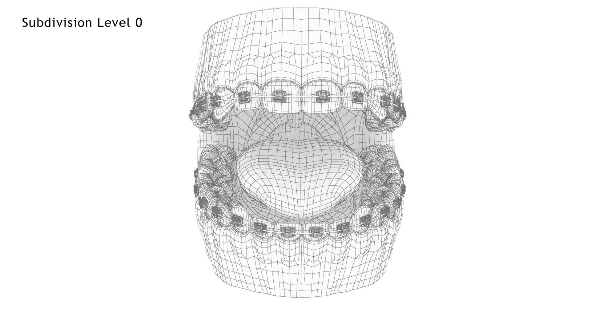 Human Mouth With Self Ligating Transparent Dental Braces V02 model https://p.turbosquid.com/ts-thumb/1e/DwIjGZ/Tc/mouthwithselfligatingsteeldentalbraces_wire1.0/jpg/1709546314/1920x1080/fit_q87/ae8feb491aba350d239af909f74ebf0ae39f124b/mouthwithselfligatingsteeldentalbraces_wire1.0.jpg