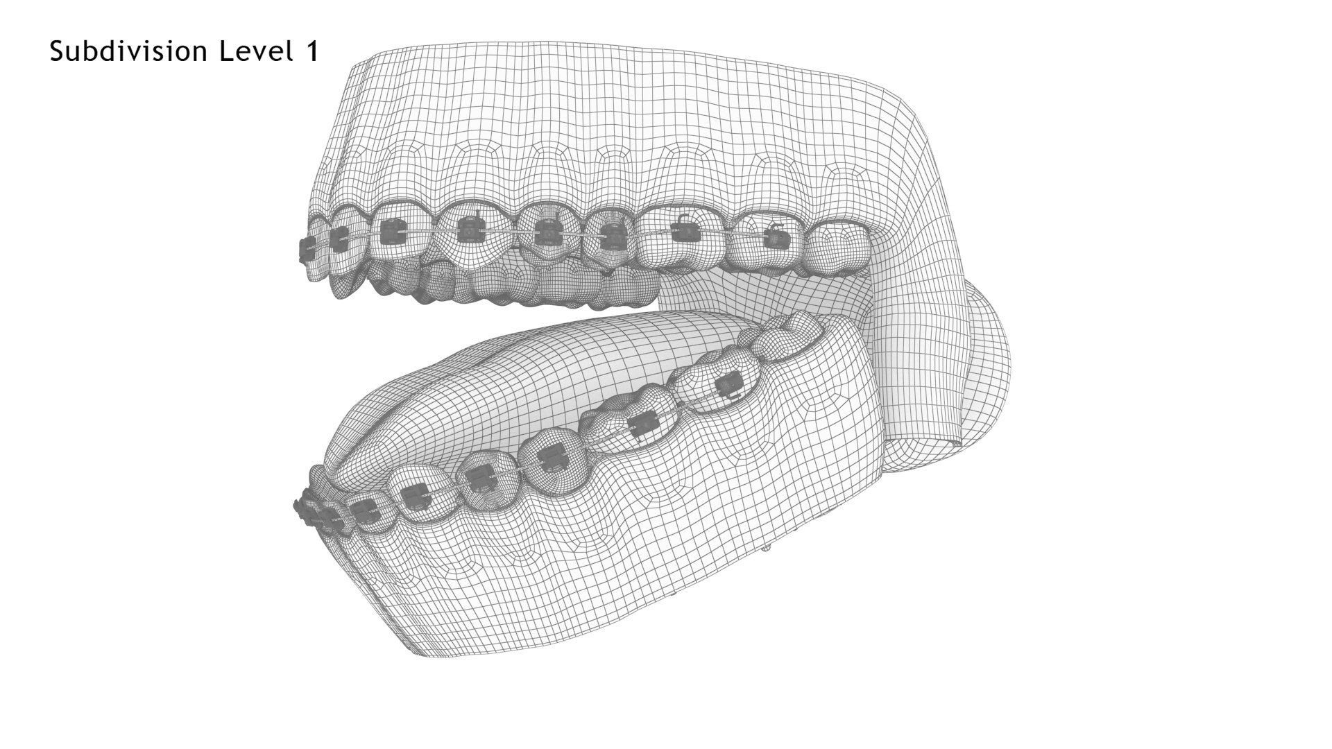 Human Mouth With Self Ligating Transparent Dental Braces V02 model https://p.turbosquid.com/ts-thumb/1e/DwIjGZ/Vs/mouthwithselfligatingsteeldentalbraces_wire4.1/jpg/1709546318/1920x1080/fit_q87/d278c871bac2a3257097990a544753f42a958f39/mouthwithselfligatingsteeldentalbraces_wire4.1.jpg