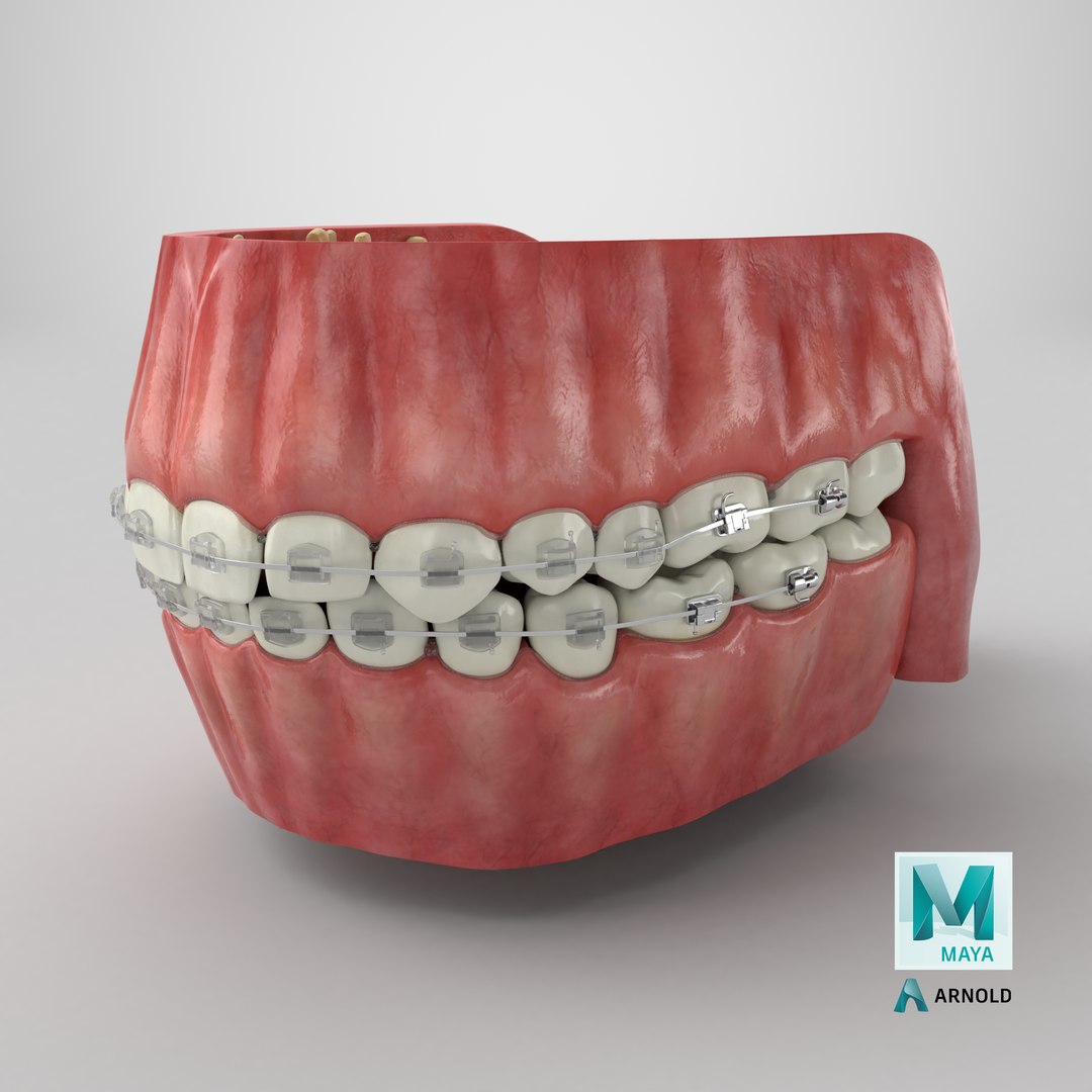 Human Mouth With Self Ligating Transparent Dental Braces V02 model https://p.turbosquid.com/ts-thumb/1e/DwIjGZ/a1/stemcell_maya_arnold_render/png/1710086122/1920x1080/fit_q87/57f65040a802731eb49d769ca524056ba21374bc/stemcell_maya_arnold_render.jpg
