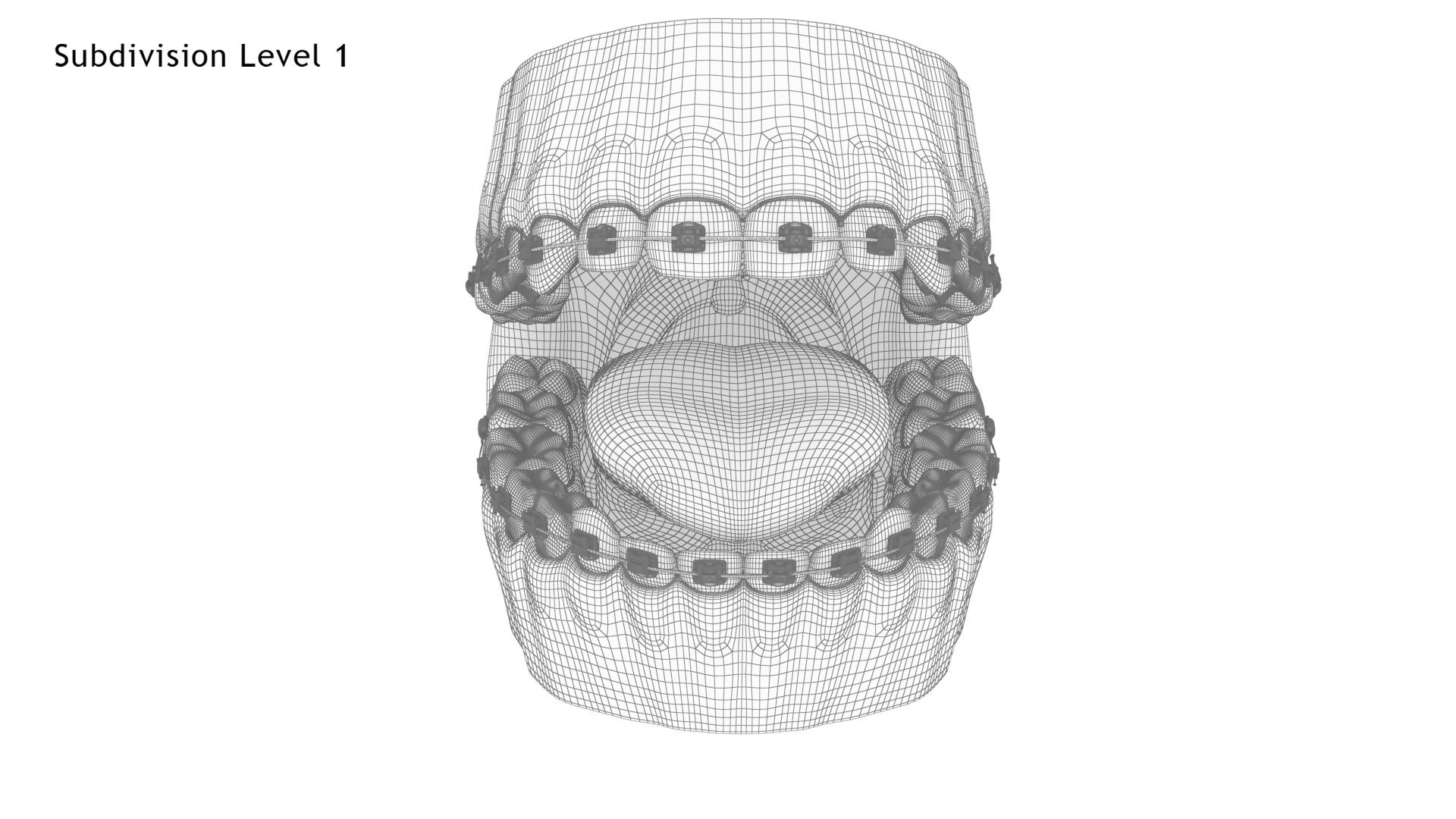 Human Mouth With Self Ligating Transparent Dental Braces V02 model https://p.turbosquid.com/ts-thumb/1e/DwIjGZ/kC/mouthwithselfligatingsteeldentalbraces_tunwireopn1/jpg/1709546146/1920x1080/turn_fit_q99/76d7fd44f1f4457ed9b5ea38967b3e6d7c5bbf5d/mouthwithselfligatingsteeldentalbraces_tunwireopn1-1.jpg