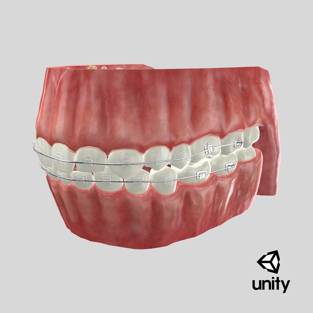 Human Mouth With Self Ligating Transparent Dental Braces V02 model https://p.turbosquid.com/ts-thumb/1e/DwIjGZ/kF/stemcell_unity_render/png/1710086136/1920x1080/fit_q87/904cc69bd21219dd5aba5189084b5faf23f43b1d/stemcell_unity_render.jpg