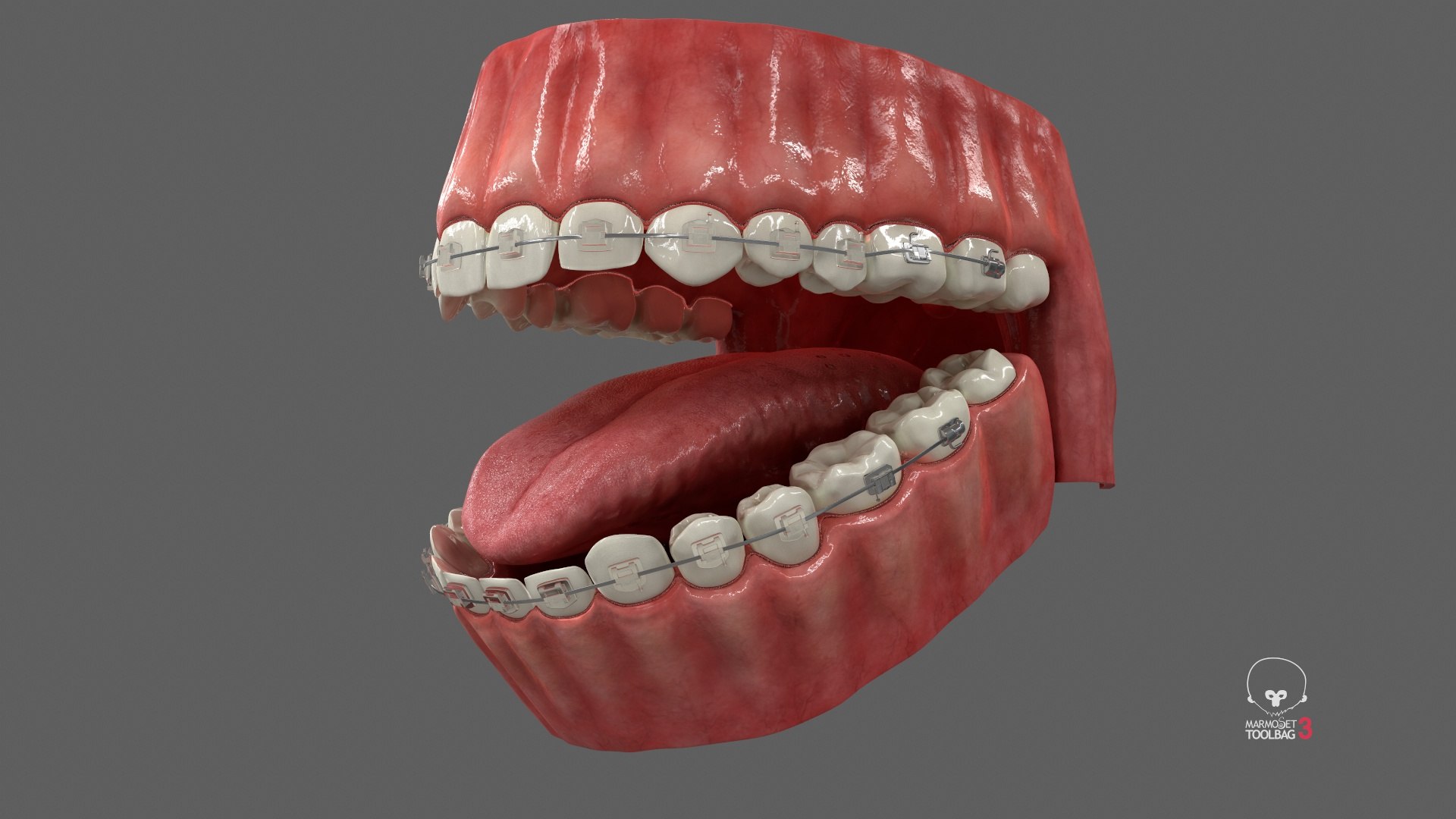 Human Mouth With Self Ligating Transparent Dental Braces V02 model https://p.turbosquid.com/ts-thumb/1e/DwIjGZ/uL/screenshot001/jpg/1709546271/1920x1080/fit_q87/3e74de9ffe469c78b7d05732b3a3f57d3509c47e/screenshot001.jpg