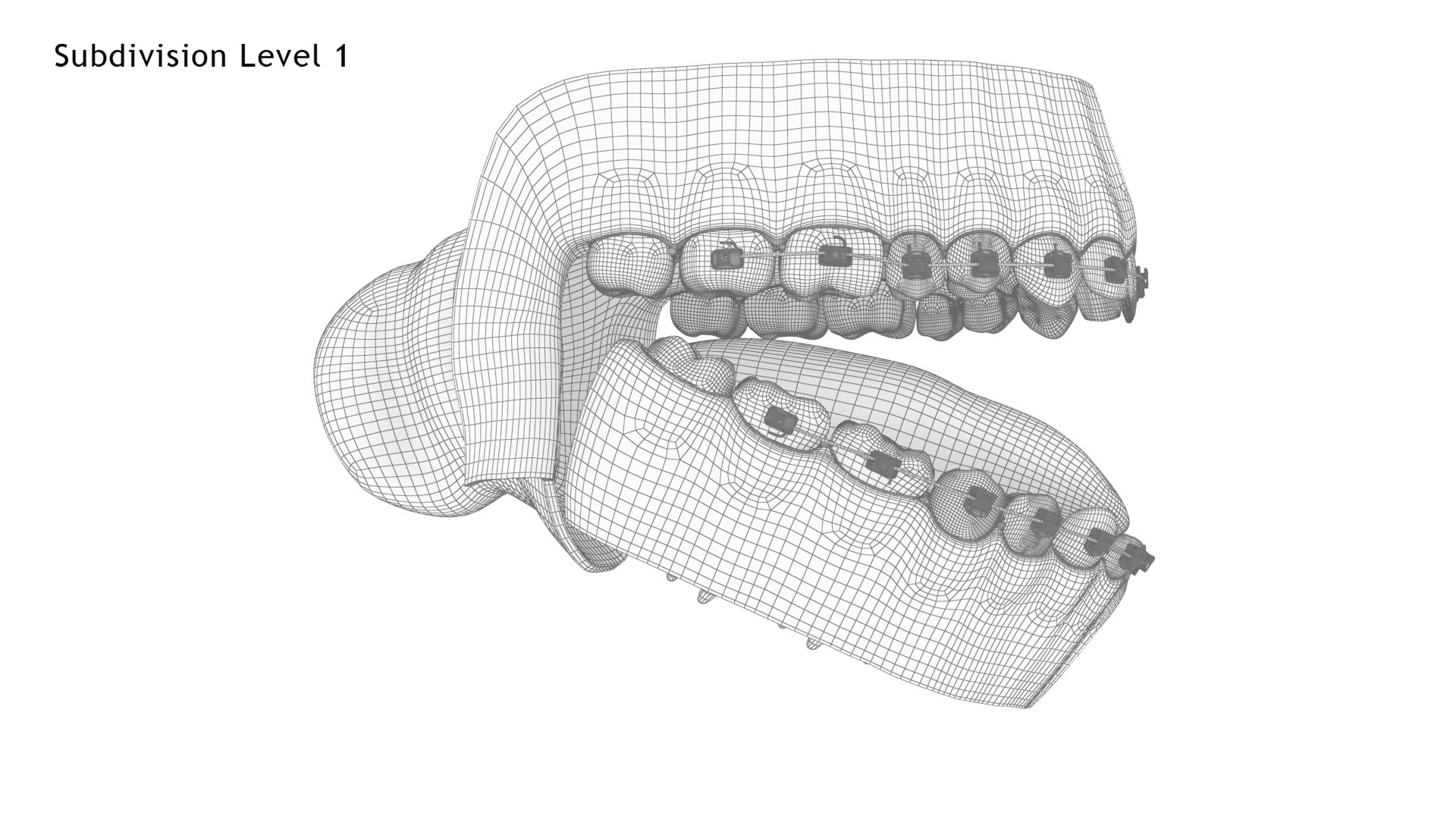 Human Mouth With Self Ligating Transparent Dental Braces V02 model https://p.turbosquid.com/ts-thumb/1e/DwIjGZ/ug/mouthwithselfligatingsteeldentalbraces_wire2.1/jpg/1709546315/1920x1080/fit_q87/44329afac7f5197cd4a476c56d5447b8963fc5f5/mouthwithselfligatingsteeldentalbraces_wire2.1.jpg