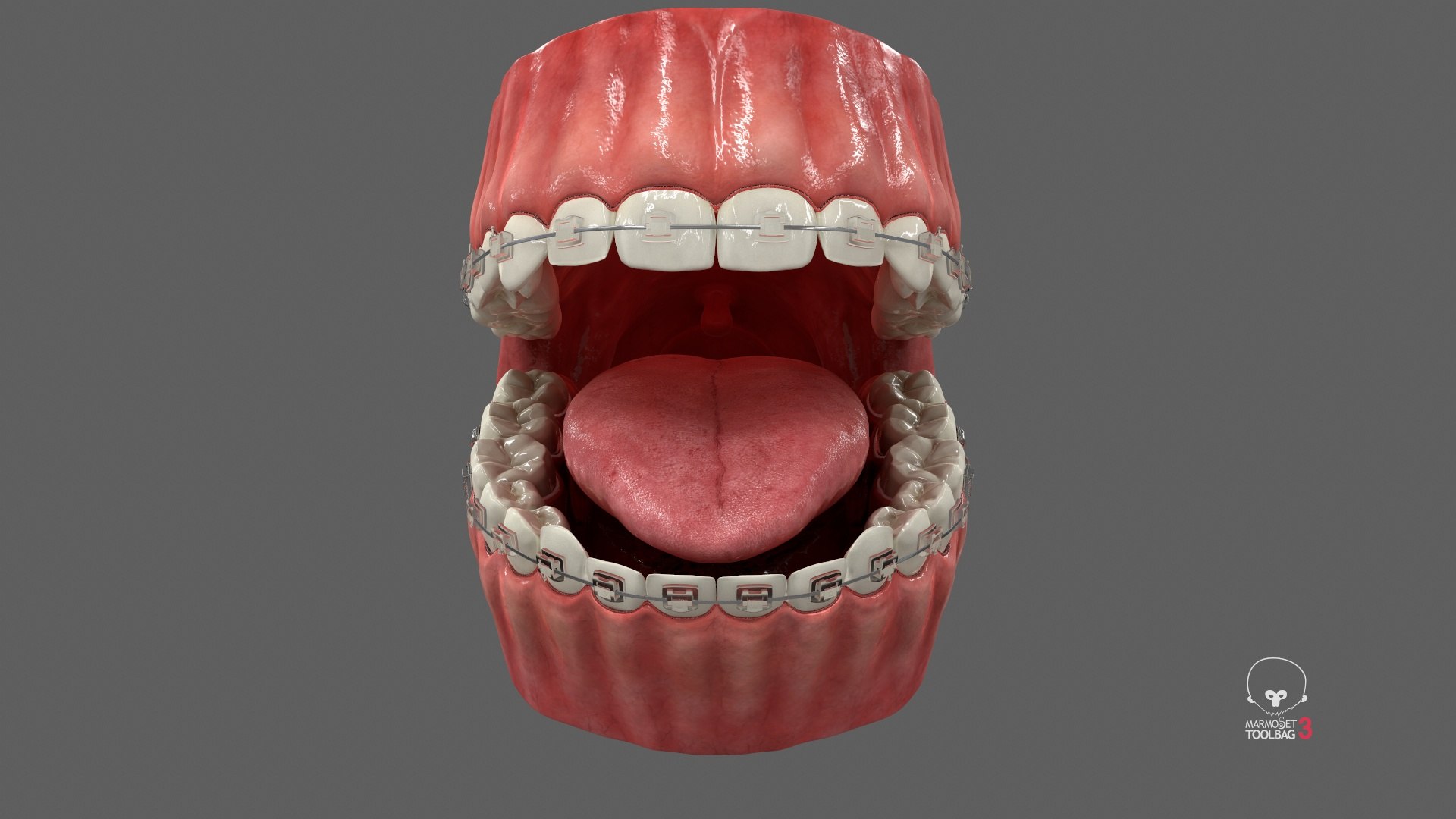 Human Mouth With Self Ligating Transparent Dental Braces V02 model https://p.turbosquid.com/ts-thumb/1e/DwIjGZ/wt/screenshot000/jpg/1709546270/1920x1080/fit_q87/996cac476c4fe4abbf00724e9ff79fe2da758ce4/screenshot000.jpg