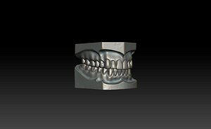 Teeth Mold - 3D Model by dcbittorf