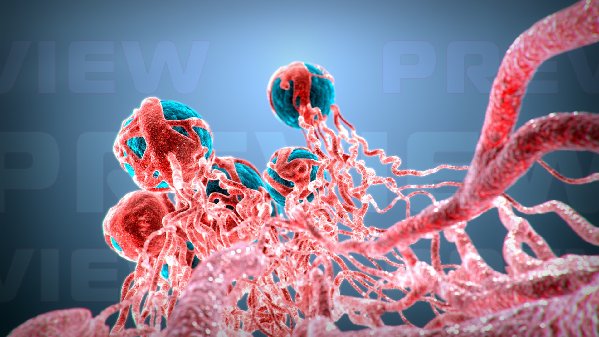 3D Cancer Growth 2 Static - TurboSquid 1204157