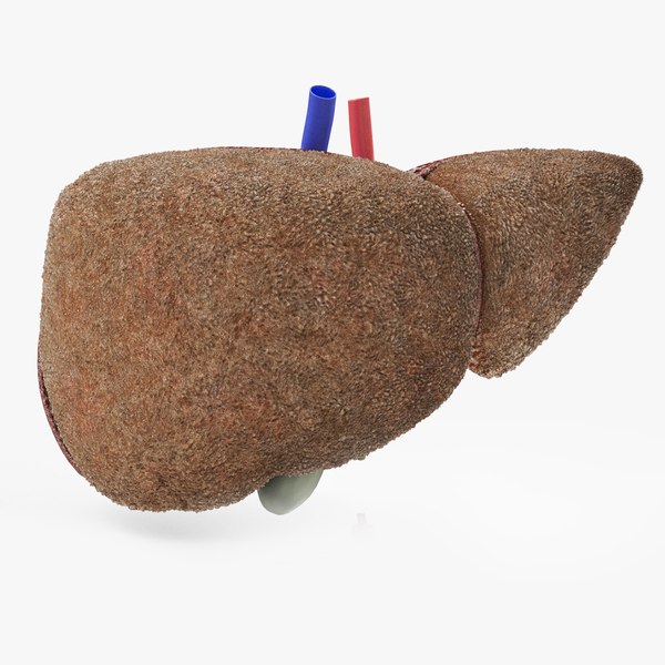 Steatohepatitis Liver 3D model