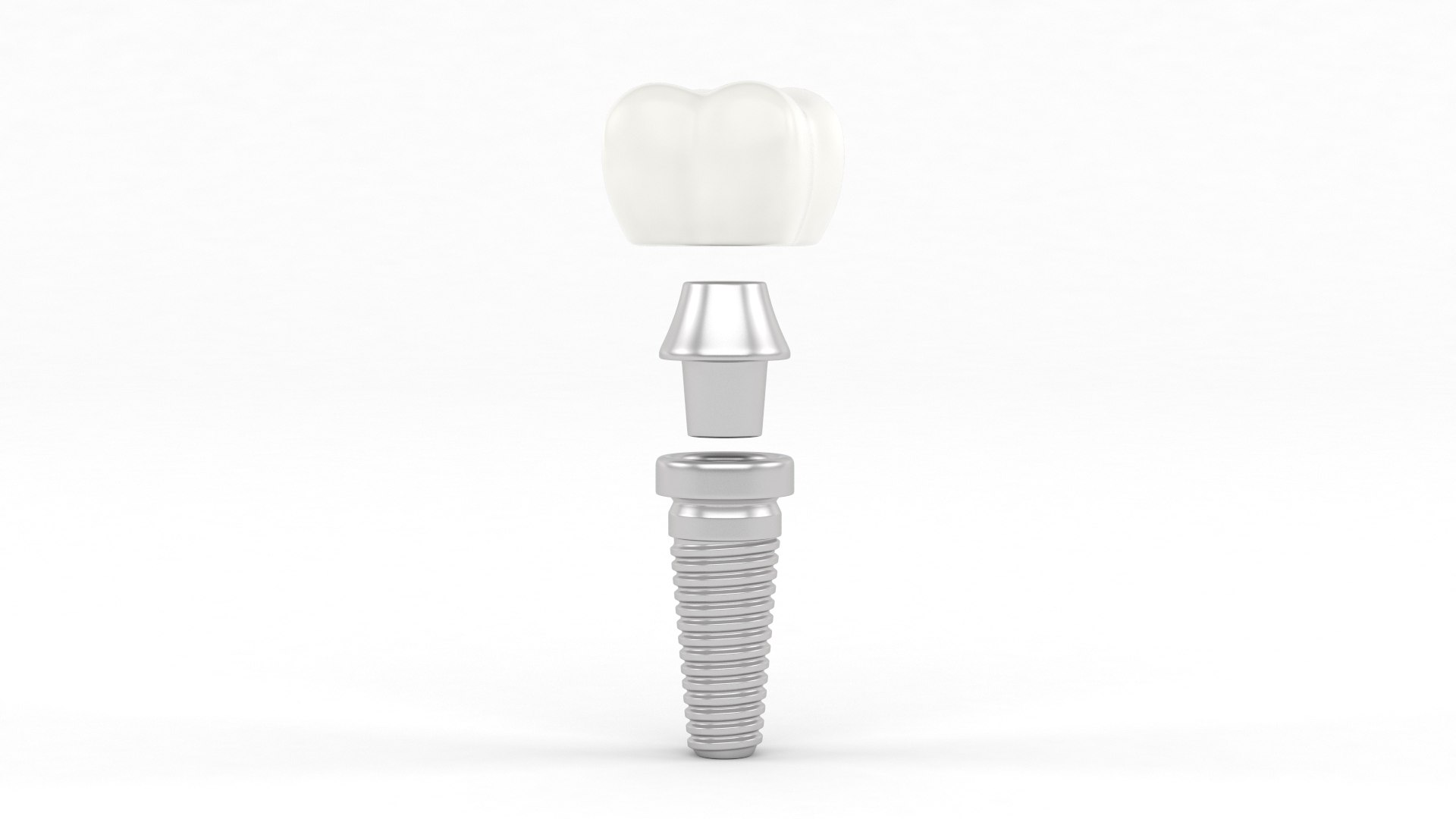 3D Model Tooth Implants - TurboSquid 2356670