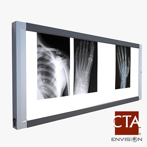 Xray Light Box