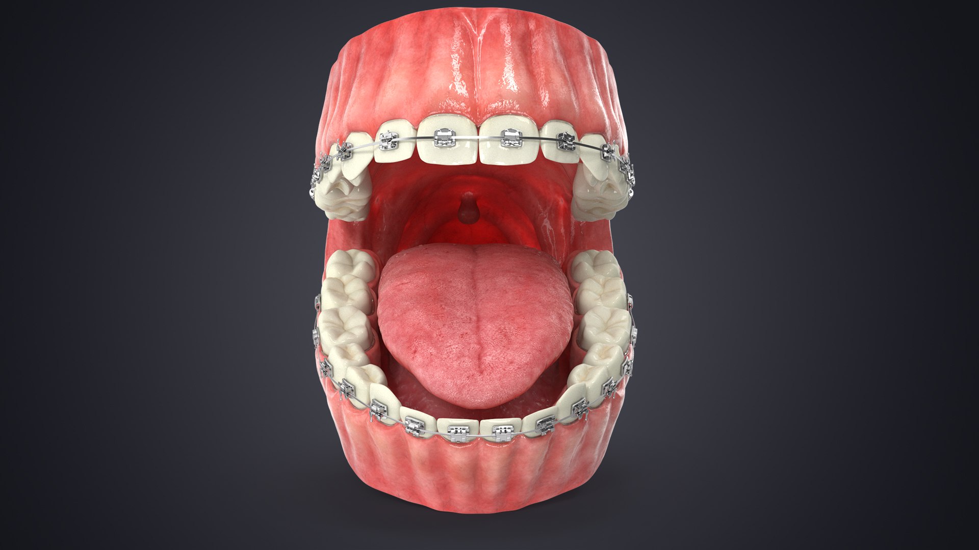 3D model Human Mouth With Self Ligating Steel Dental Braces V03 https://p.turbosquid.com/ts-thumb/2N/dOumDw/9K/contextsignature/jpg/1710306506/1920x1080/fit_q87/983df239e18be4c325d81317f7f374e82c290ddf/contextsignature.jpg