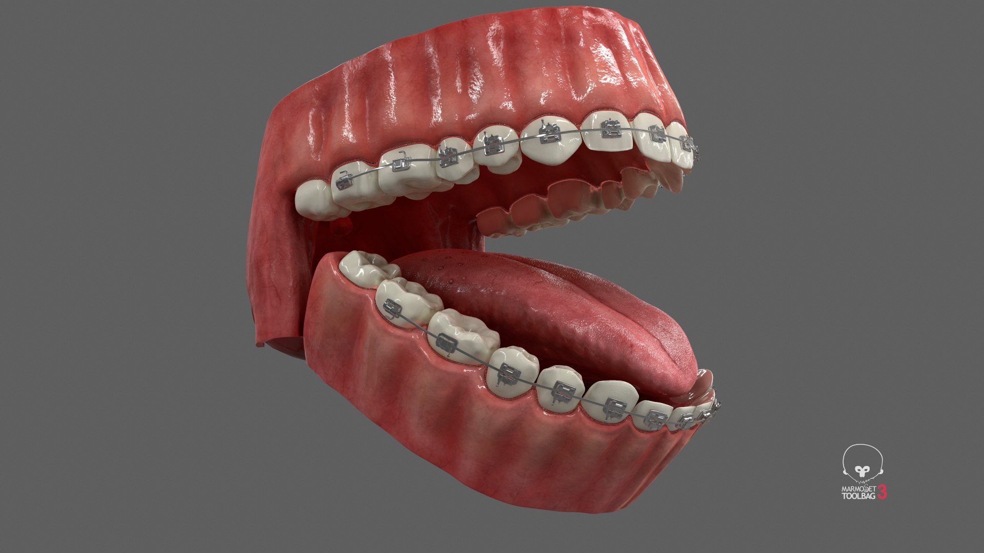 3D model Human Mouth With Self Ligating Steel Dental Braces V03 https://p.turbosquid.com/ts-thumb/2N/dOumDw/Ho/screenshot004/jpg/1710306850/1920x1080/fit_q87/3b7b091b0cf16cbd3d5e3142918022ebd7f3c4b0/screenshot004.jpg