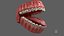 Human Mouth With Self Ligating Steel Dental Braces V03
