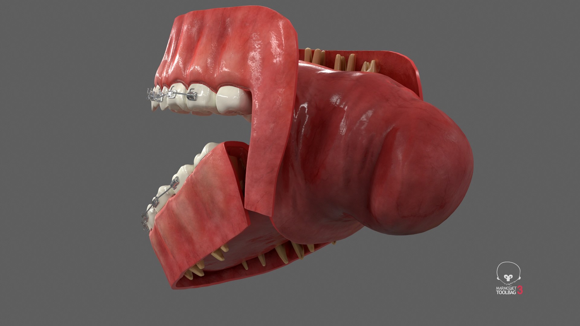 3D model Human Mouth With Self Ligating Steel Dental Braces V03 https://p.turbosquid.com/ts-thumb/2N/dOumDw/N3/screenshot002/jpg/1710306847/1920x1080/fit_q87/35f90135ccbd38e20e0d6e756b6a38e07c8b087f/screenshot002.jpg