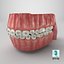 Human Mouth With Self Ligating Steel Dental Braces V03