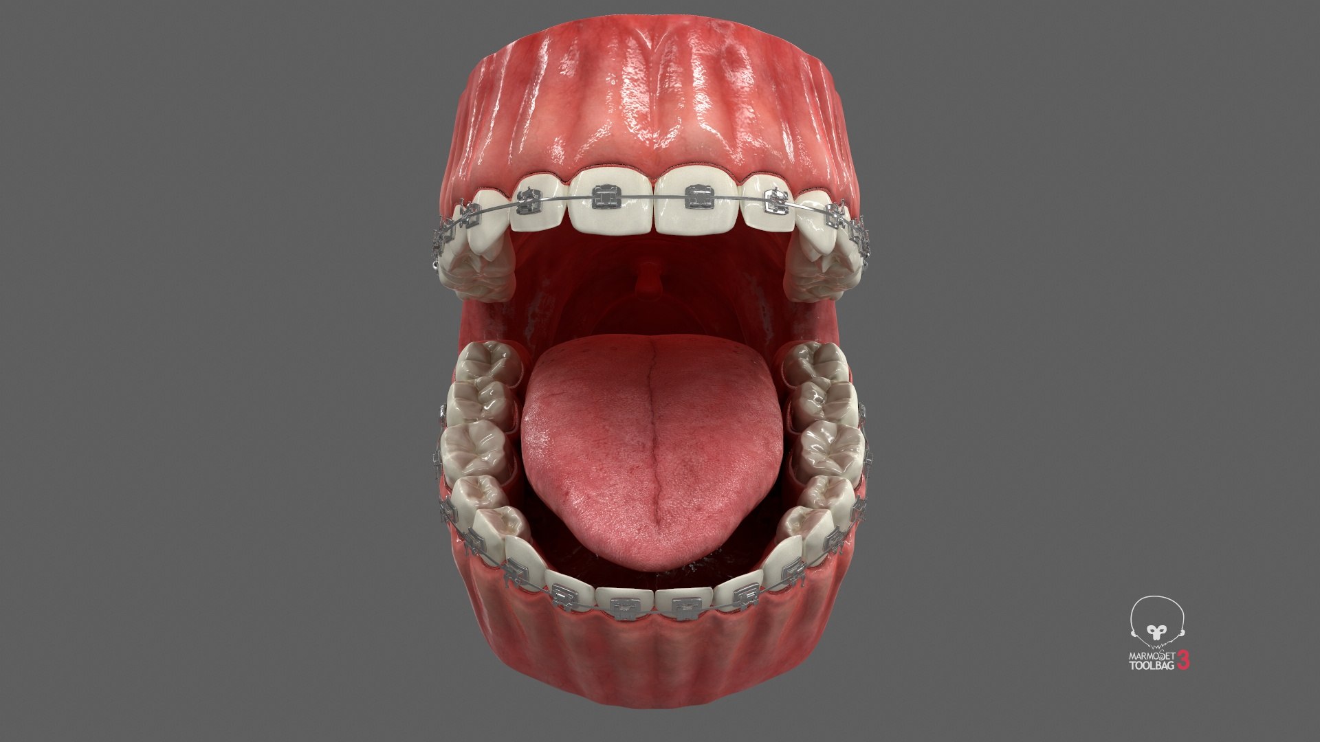3D model Human Mouth With Self Ligating Steel Dental Braces V03 https://p.turbosquid.com/ts-thumb/2N/dOumDw/Uv/screenshot000/jpg/1710306847/1920x1080/fit_q87/ae044dfeaa5477a02c3ce8d1764217025a978ed4/screenshot000.jpg