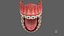 Human Mouth With Self Ligating Steel Dental Braces V03