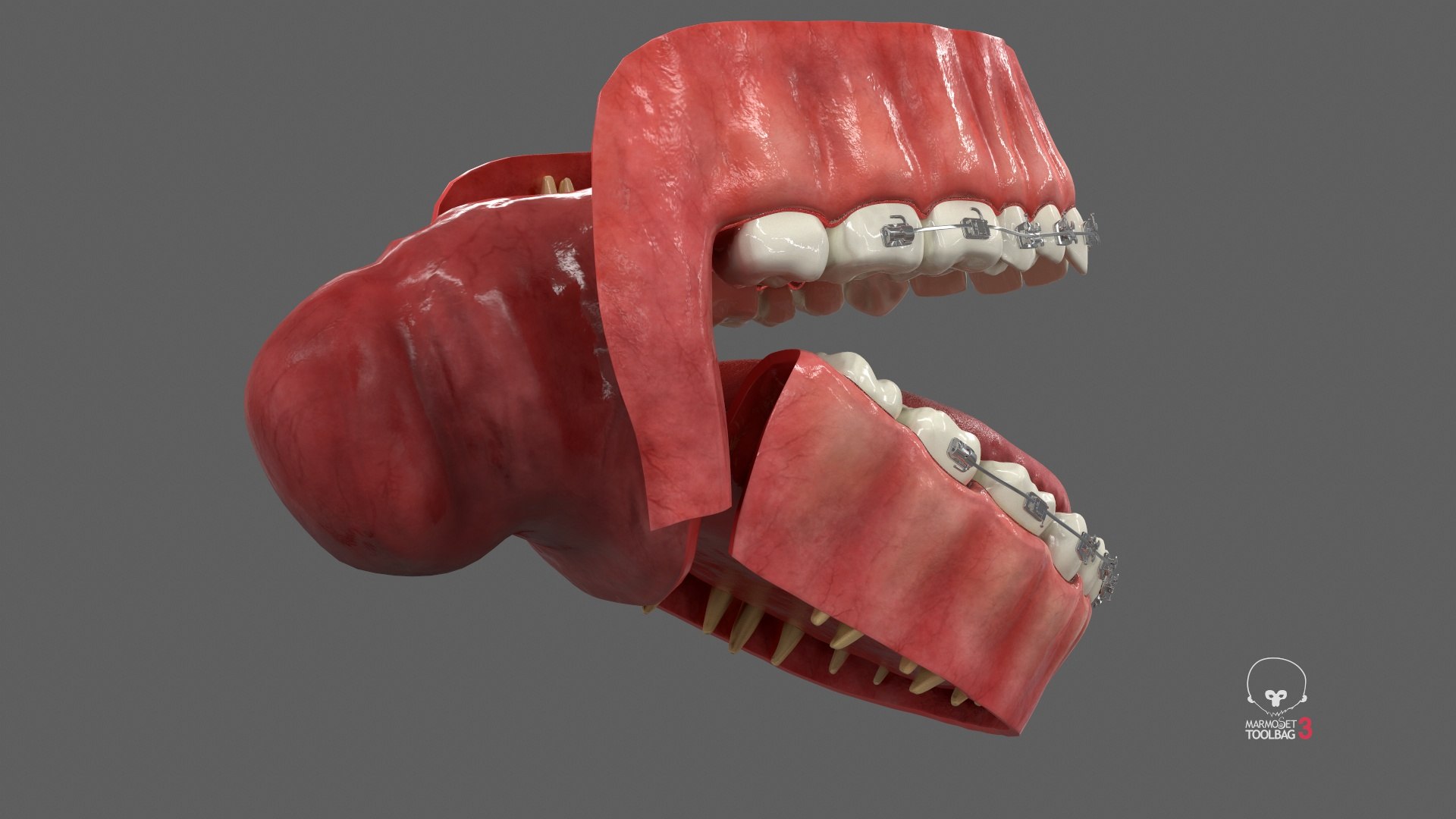 3D model Human Mouth With Self Ligating Steel Dental Braces V03 https://p.turbosquid.com/ts-thumb/2N/dOumDw/jS/screenshot003/jpg/1710306849/1920x1080/fit_q87/dbe0a0937d0effd707dcbd5bc730e861b4a0fe4e/screenshot003.jpg