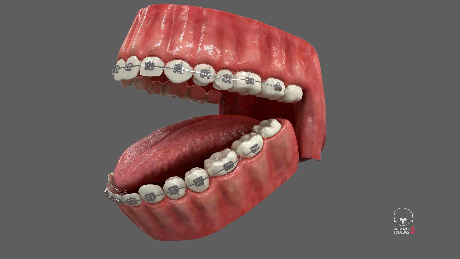 3D model Human Mouth With Self Ligating Steel Dental Braces V03 https://p.turbosquid.com/ts-thumb/2N/dOumDw/jf/screenshot001/jpg/1710306847/1920x1080/fit_q87/f423e8b4181936ed671b1330a22adef9be07d78d/screenshot001.jpg
