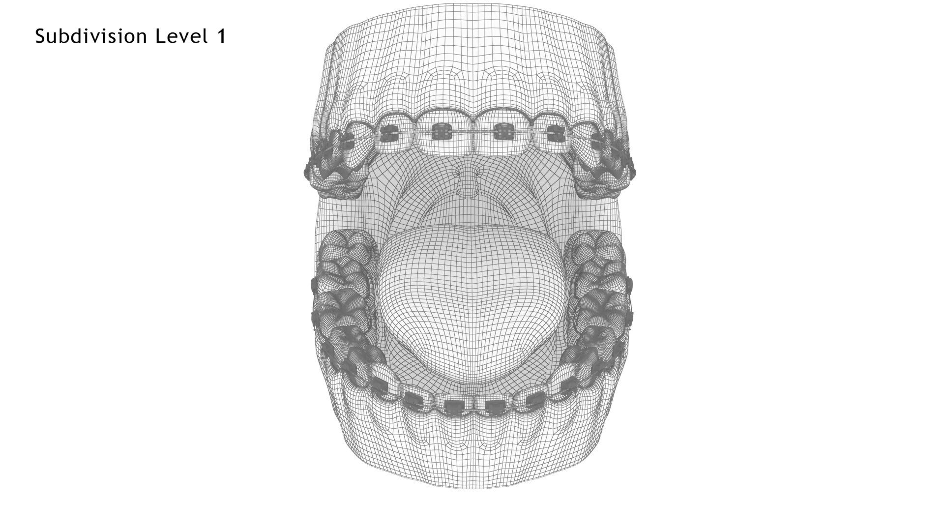 3D model Human Mouth With Self Ligating Steel Dental Braces V03 https://p.turbosquid.com/ts-thumb/2N/dOumDw/jw/mouth_with_steel_dental_braces_preswire4.1/jpg/1710307291/1920x1080/fit_q87/77ab4e3edb1f4483e90a28afbaad4d5dc7bc4f64/mouth_with_steel_dental_braces_preswire4.1.jpg